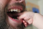Implanty zębowe to świetny wynalazek , który pozwala na zdrowy zgryz